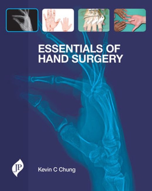 Essentials of Hand Surgery, Hardback Book