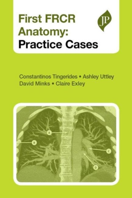 First FRCR Anatomy : Practice Cases, Paperback / softback Book