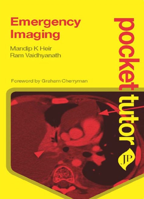 Pocket Tutor Emergency Imaging, Paperback / softback Book