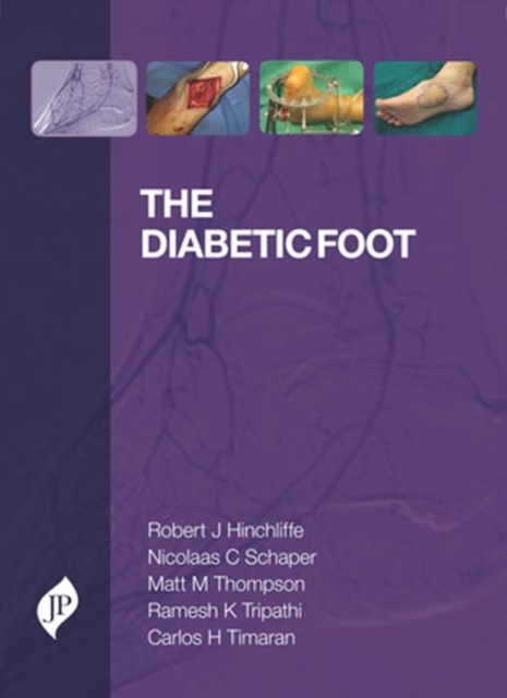 The Diabetic Foot, Hardback Book