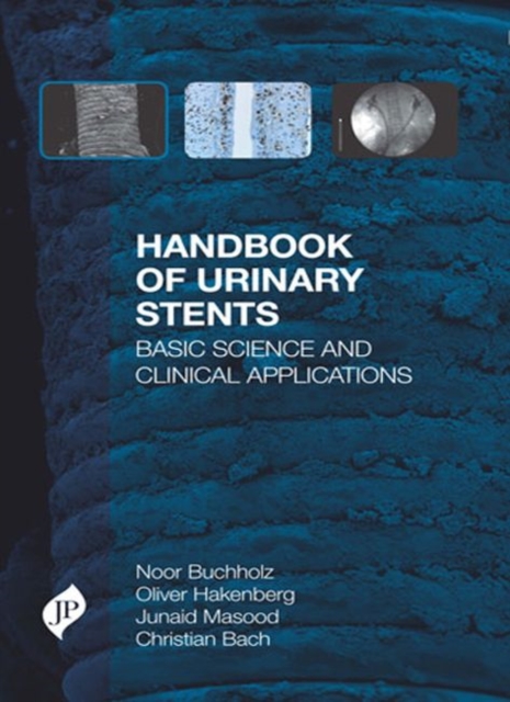Handbook of Urinary Stents : Basic Science and Clinical Applications, Hardback Book