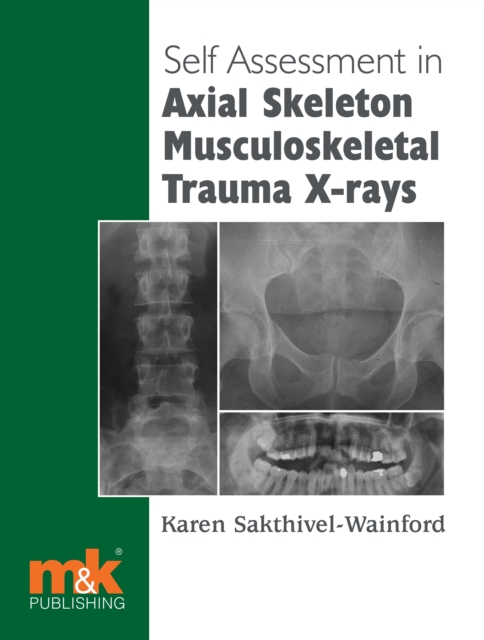 Self-assessment in Axial Musculoskeletal Trauma X-rays, EPUB eBook