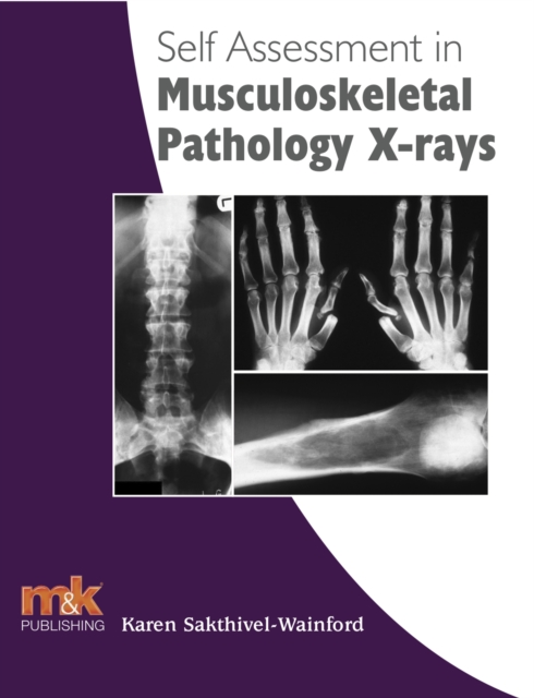 Self Assessment in Musculoskeletal Pathology X-rays, EPUB eBook