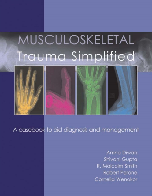 Musculoskeletal Trauma Simplified, EPUB eBook