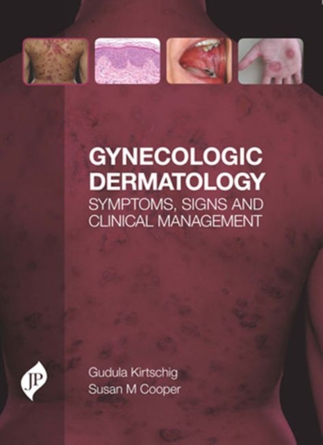 Gynecologic Dermatology : Symptoms, Signs and Clinical Management, Hardback Book