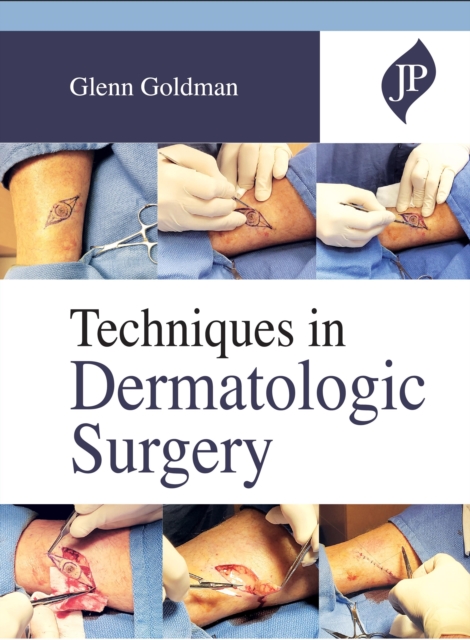 Techniques in Dermatologic Surgery, Hardback Book