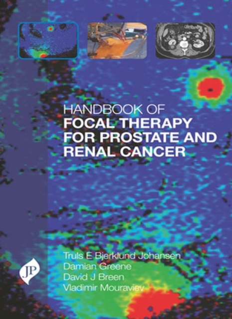 Handbook of Focal Therapy for Prostate and Renal Cancer, Hardback Book