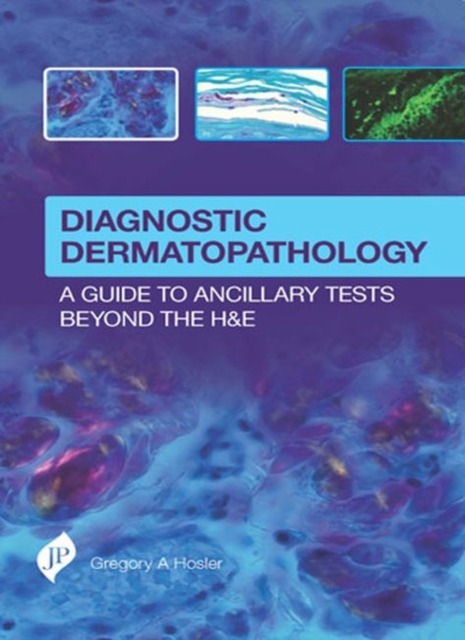 Diagnostic Dermatopathology: A Guide to Ancillary Tests Beyond the H&E, Hardback Book