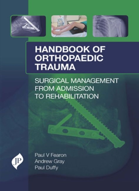 Handbook of Orthopaedic Trauma : Surgical Management from Admission to Rehabilitation, Hardback Book