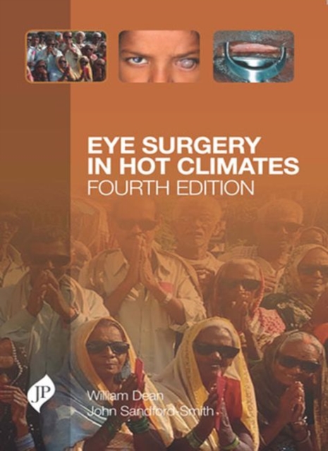 Eye Surgery in Hot Climates, Paperback / softback Book
