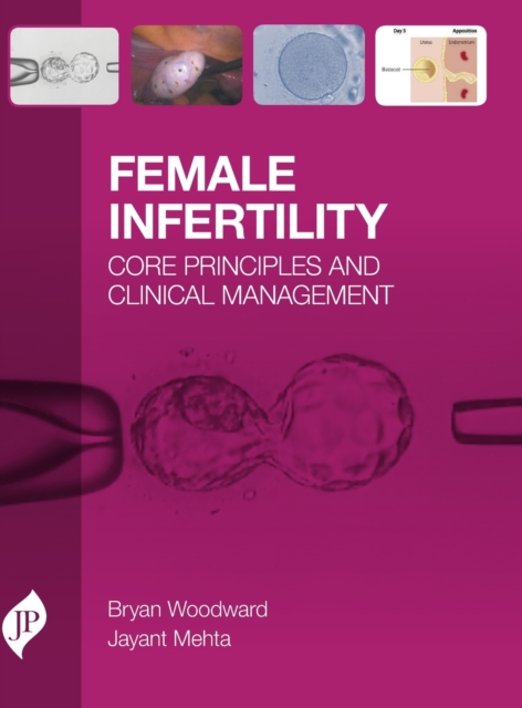 Female Infertility : Core Principles and Clinical Management, Hardback Book