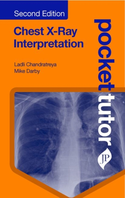 Pocket Tutor Chest X-Ray Interpretation : Second Edition, Paperback / softback Book