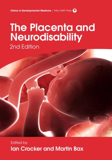The Placenta and Neurodisability 2nd Edition, EPUB eBook