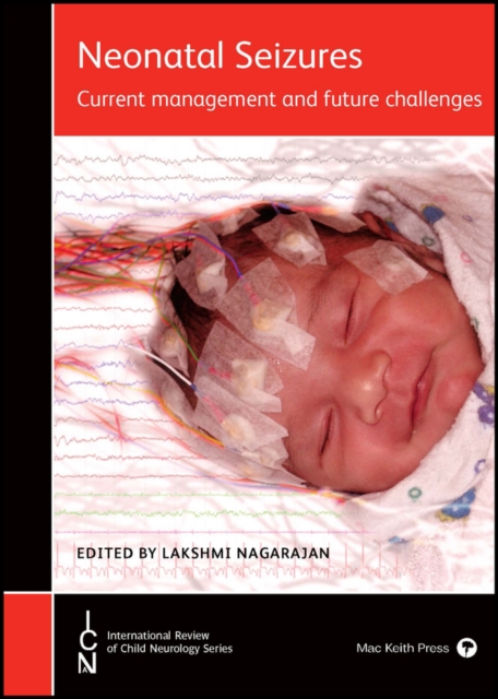 Neonatal Seizures : Current Management and Future Challenges, Hardback Book