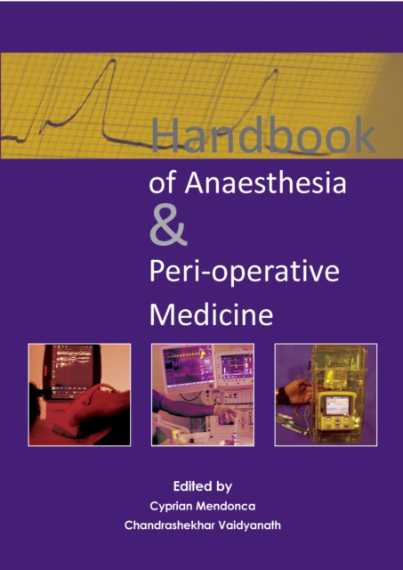 Handbook of Anaesthesia & Peri-operative Medicine, PDF eBook
