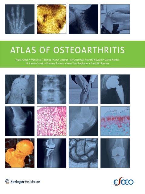Atlas of Osteoarthritis, Paperback / softback Book
