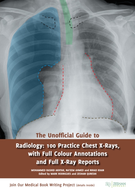 The Unofficial Guide to Radiology : 100 Practice Chest X-Rays, with Full Colour Annotations and Full X-Ray Reports, EPUB eBook