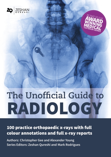 The Unofficial Guide to Radiology : 100 Practice Orthopaedic X-Rays with Full Colour Annotations and Full X-Ray Reports, PDF eBook