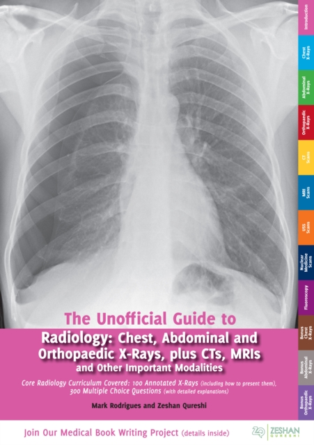 The Unofficial Guide to Radiology : Chest, Abdominal, Orthopaedic X Rays, plus CTs, MRIs and Other Important Modalities, PDF eBook