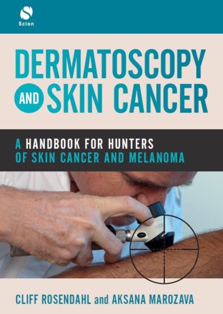 Dermatoscopy and Skin Cancer : A handbook for hunters of skin cancer and melanoma, Paperback / softback Book