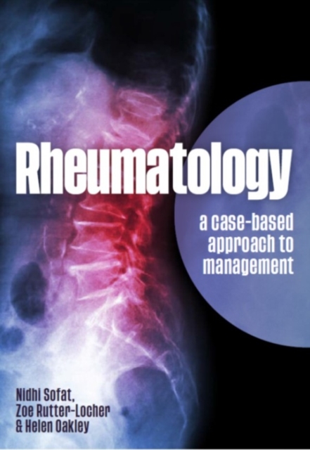 Rheumatology : A case-based approach to management, EPUB eBook