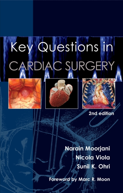 Key Questions in Cardiac Surgery, Paperback / softback Book
