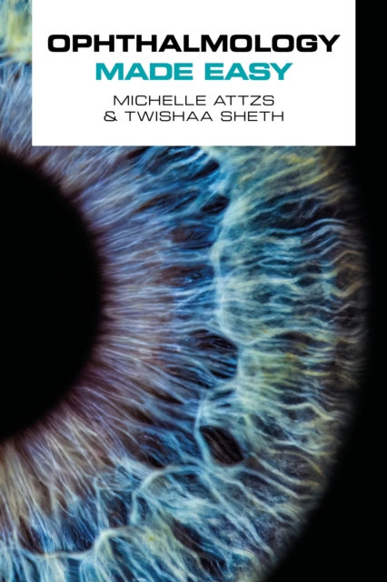Ophthalmology Made Easy, Paperback / softback Book