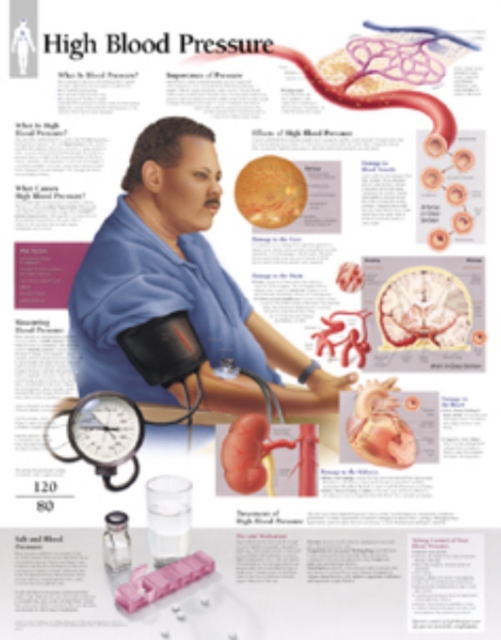High Blood Pressure Laminated Poster, Poster Book