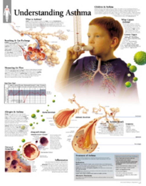 Understanding Asthma Laminated Poster, Poster Book