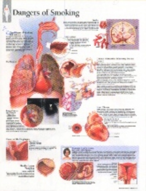 Effects of Smoking Paper Poster, Poster Book