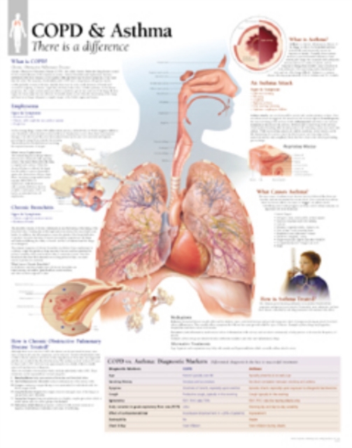 COPD & Asthma Paper Poster, Poster Book