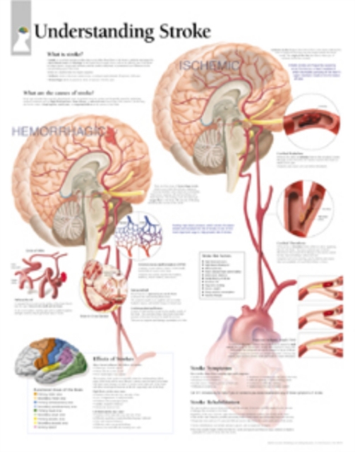 Understanding Stroke Paper Poster, Poster Book