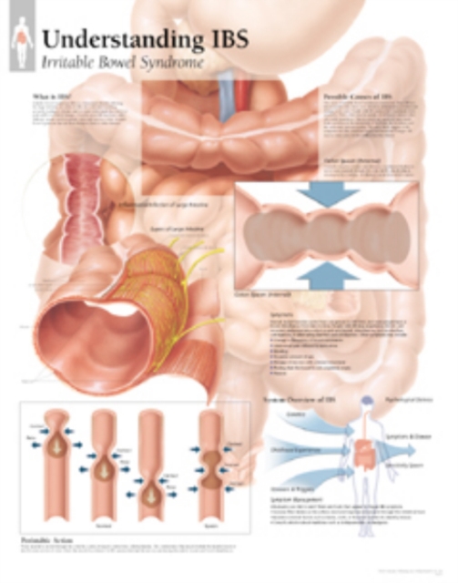 Understanding IBS Paper Poster, Poster Book