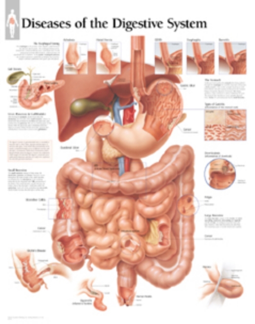 Diseases of the Digestive System Laminated Poster, Poster Book