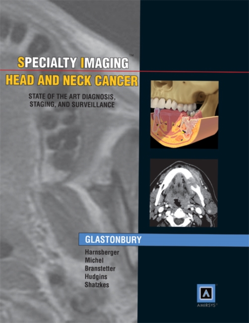 Specialty Imaging: Head & Neck Cancer : State of the Art Diagnosis, Staging, and Surveillance, Hardback Book