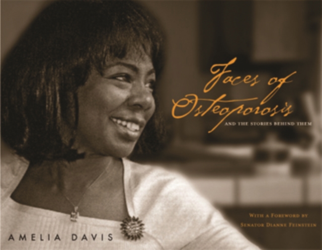 Faces of Osteoporosis, Paperback / softback Book
