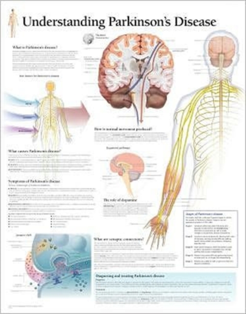 Understanding Parkinson's Paper Poster, Poster Book