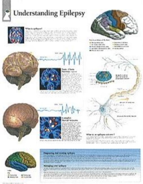 Understanding Epilepsy Paper Poster, Poster Book