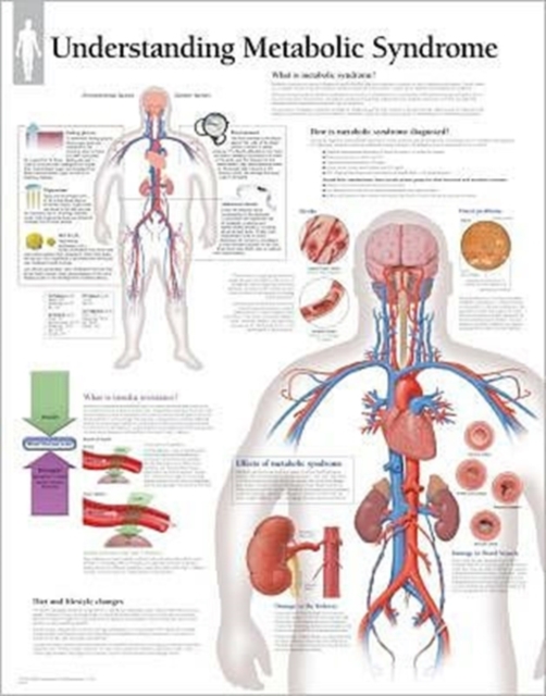 Understanding Metabolic Syndrome Paper Poster, Poster Book