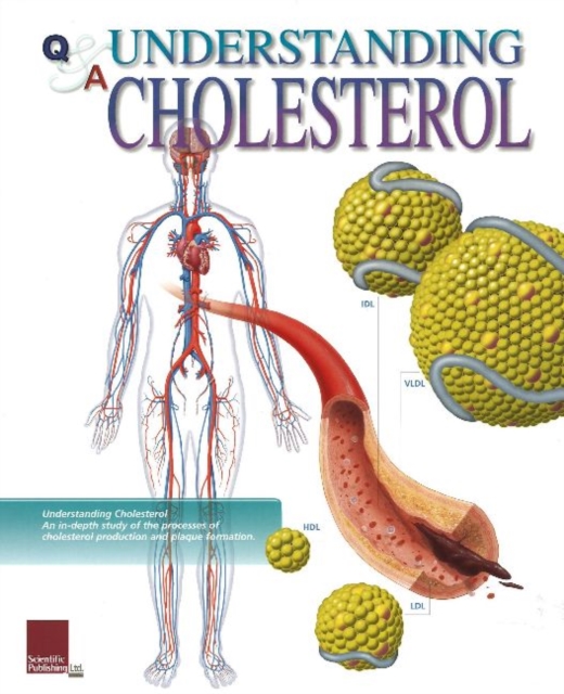 Understanding Cholesterol Flip Chart, Spiral bound Book
