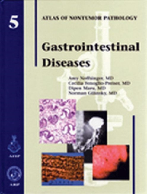 Gastrointestinal Diseases, Hardback Book