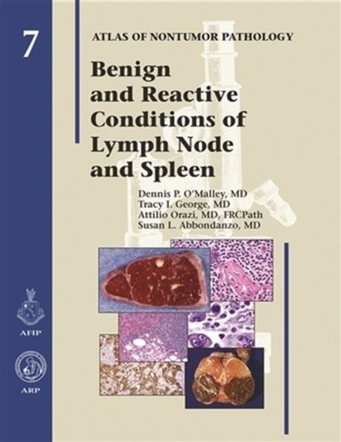 Benign and Reactive Conditions of Lymph Node and Spleen, Hardback Book