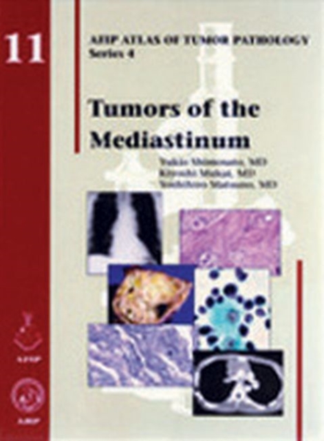 Tumors of the Mediastinum, Hardback Book