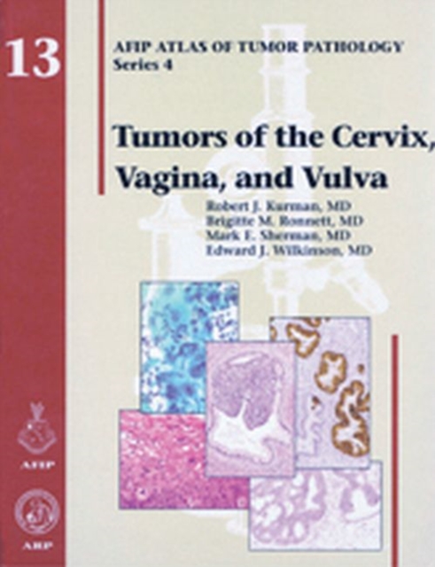 Tumors of the Cervix, Vagina, and Vulva, Hardback Book