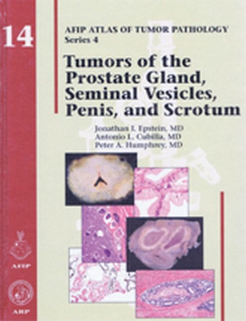 Tumors of the Prostate Gland, Seminal Vesicles, Penis, and Scrotum, Hardback Book