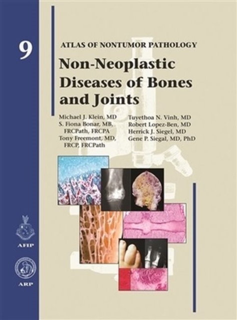 Non-Neoplastic Diseases of Bones and Joints, Hardback Book