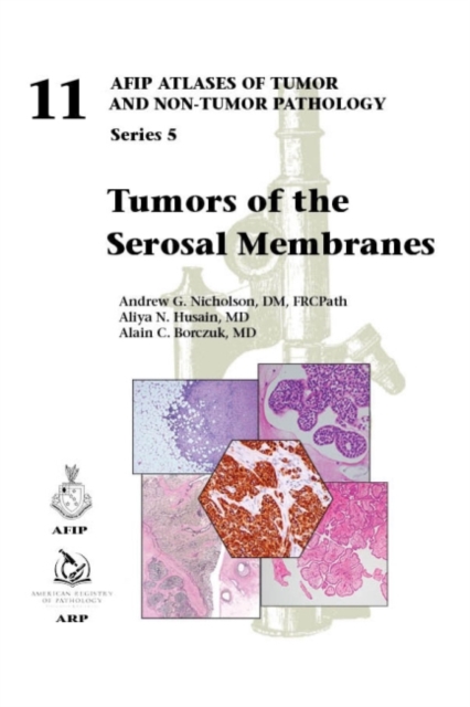 Tumors of the Serosal Membranes, Hardback Book