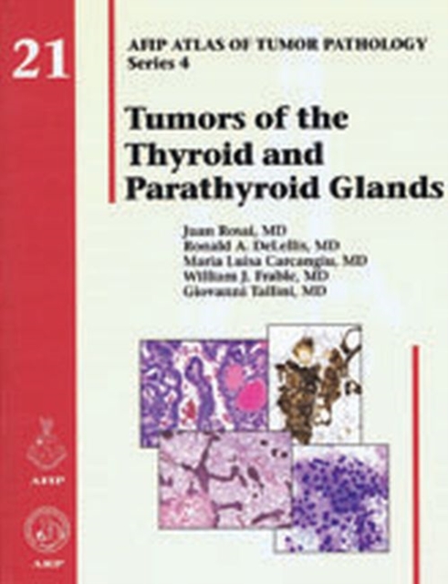 Tumors of the Thyroid and Parathyroid Glands, Hardback Book