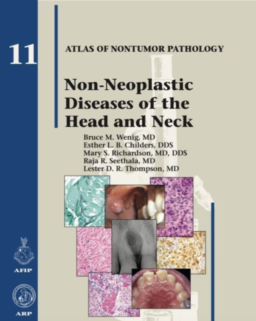 Non-Neoplastic Diseases of the Head and Neck, Hardback Book