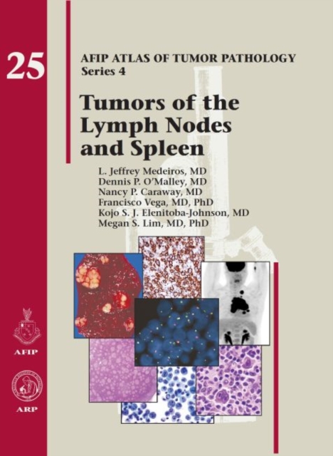 Tumors of the Lymph Nodes and Spleen, Hardback Book